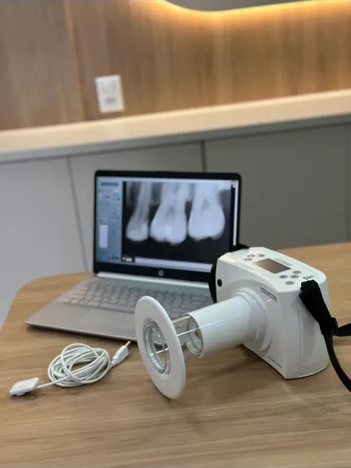 Aparelho de radiografia digital da Clínica Oral Sorriso, com a radiografia na tela