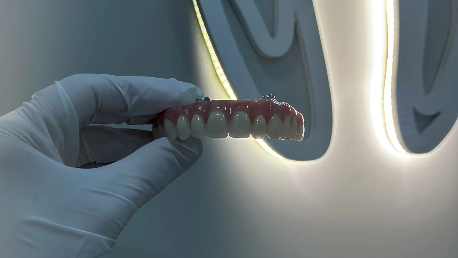 Prótese protocolo da Clínica Oral Sorriso, com os encaixes sobre implantes